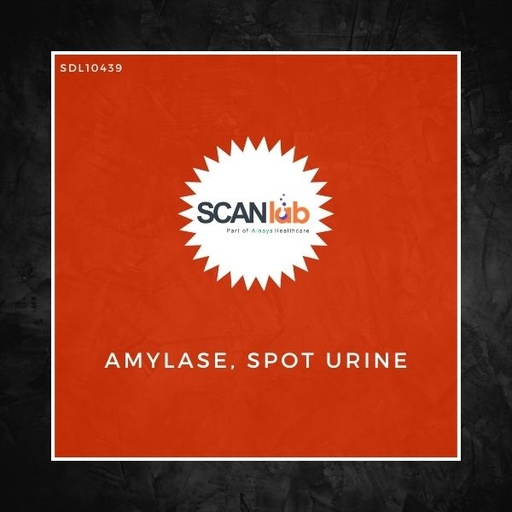 [SDL10439] AMYLASE, SPOT URINE (SDL10439)