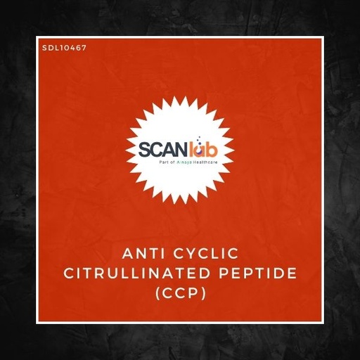 [SDL10467] ANTI CYCLIC CITRULLINATED PEPTIDE (CCP) (SDL10467)