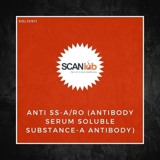 [SDL10511] ANTI SS-A/RO (ANTIBODY SERUM SOLUBLE SUBSTANCE-A ANTIBODY) (SDL10511)