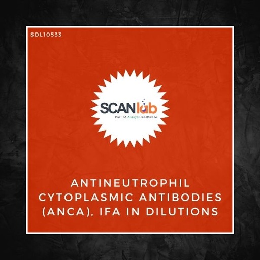 [SDL10533] ANTINEUTROPHIL CYTOPLASMIC ANTIBODIES (ANCA), IFA IN DILUTIONS (SDL10533)