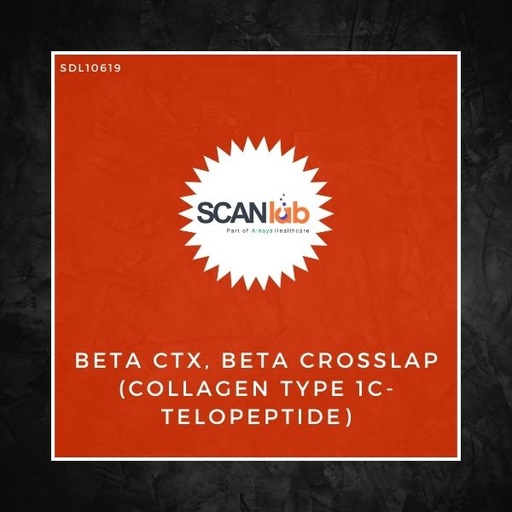 [SDL10619] BETA CTX, BETA CROSSLAP (COLLAGEN TYPE 1C- TELOPEPTIDE) (SDL10619)