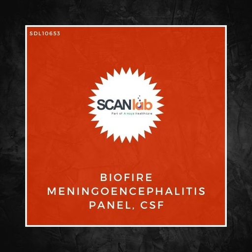 [SDL10653] BIOFIRE MENINGOENCEPHALITIS PANEL, CSF (SDL10653)