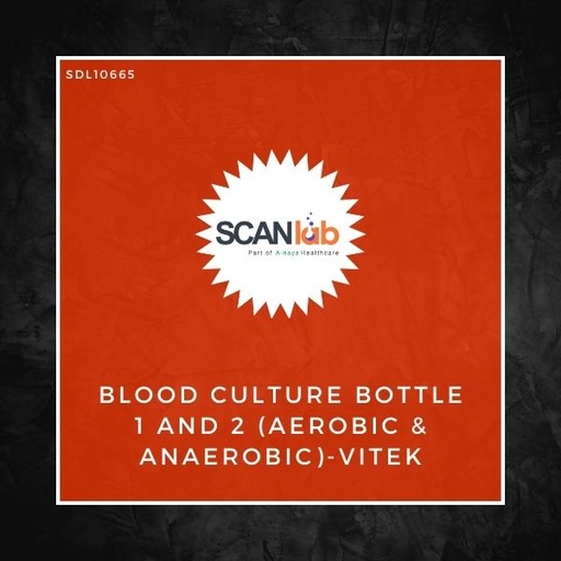 [SDL10665] BLOOD CULTURE BOTTLE 1 AND 2 (AEROBIC & ANAEROBIC)-VITEK (SDL10665)