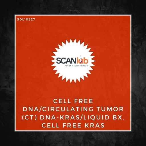 [SDL10827] CELL FREE DNA/CIRCULATING TUMOR (CT) DNA-KRAS/LIQUID BX. CELL FREE KRAS (SDL10827)