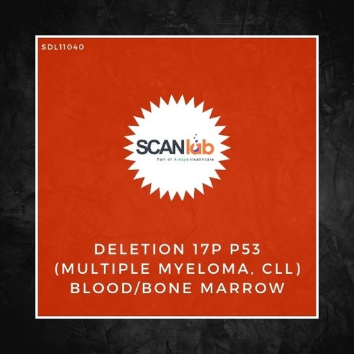 [SDL11040] DELETION 17P P53 (MULTIPLE MYELOMA, CLL) BLOOD/BONE MARROW (SDL11040)