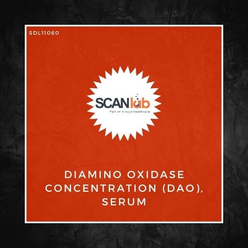 [SDL11060] DIAMINO OXIDASE CONCENTRATION (DAO), SERUM (SDL11060)