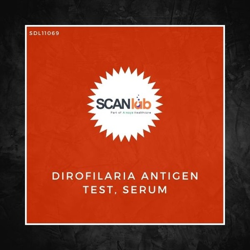 [SDL11069] DIROFILARIA ANTIGEN TEST, SERUM (SDL11069)