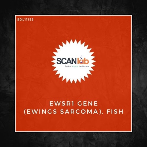 [SDL11155] EWSR1 GENE (EWINGS SARCOMA), FISH (SDL11155)