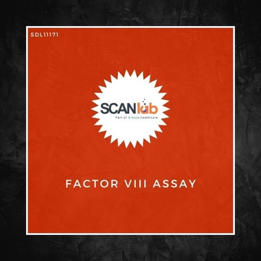 [SDL11171] FACTOR VIII ASSAY (SDL11171)