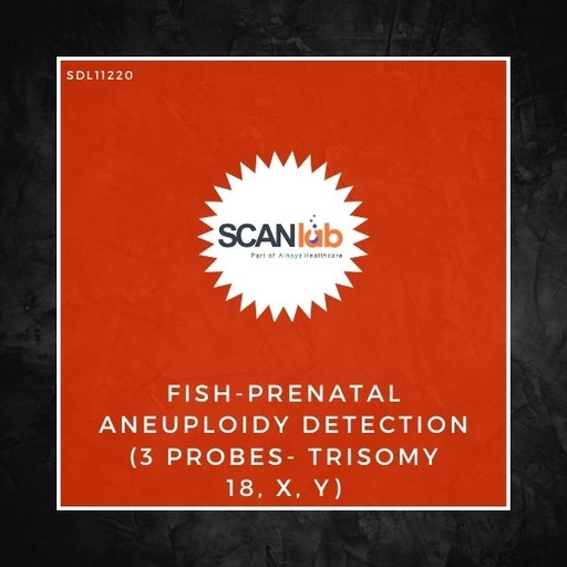 [SDL11220] FISH-PRENATAL ANEUPLOIDY DETECTION (3 PROBES- TRISOMY 18, X, Y) (SDL11220)