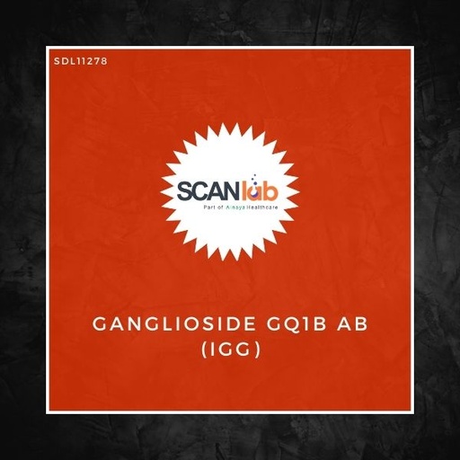 [SDL11278] GANGLIOSIDE GQ1B AB (IGG), EIA (SDL11278)
