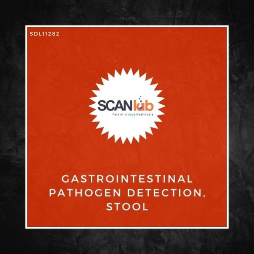 [SDL11282] GASTROINTESTINAL PATHOGEN DETECTION, STOOL (SDL11282)