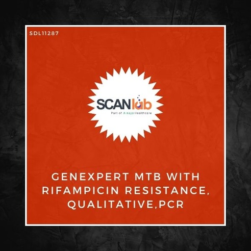 [SDL11287] GENEXPERT MTB WITH RIFAMPICIN RESISTANCE, QUALITATIVE, PCR (SDL11287)