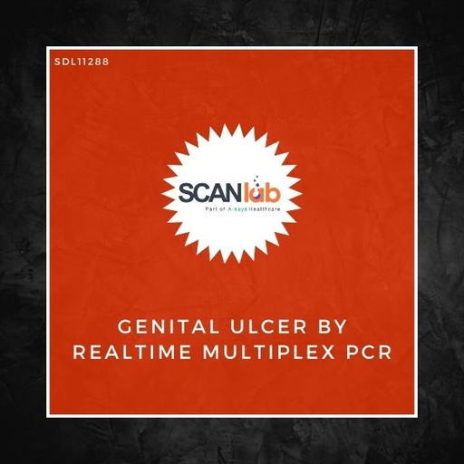 [SDL11288] GENITAL ULCER BY REALTIME MULTIPLEX PCR (SDL11288)