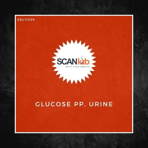 [SDL11305] GLUCOSE PP, URINE (SDL11305)