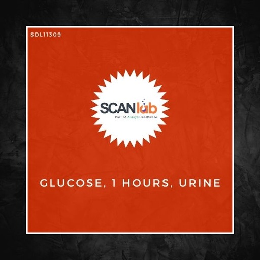 [SDL11309] GLUCOSE, 1 HOURS, URINE (SDL11309)
