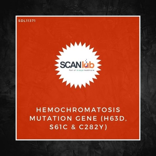 [SDL11371] HEMOCHROMATOSIS MUTATION GENE (H63D, S61C & C282Y) (SDL11371)