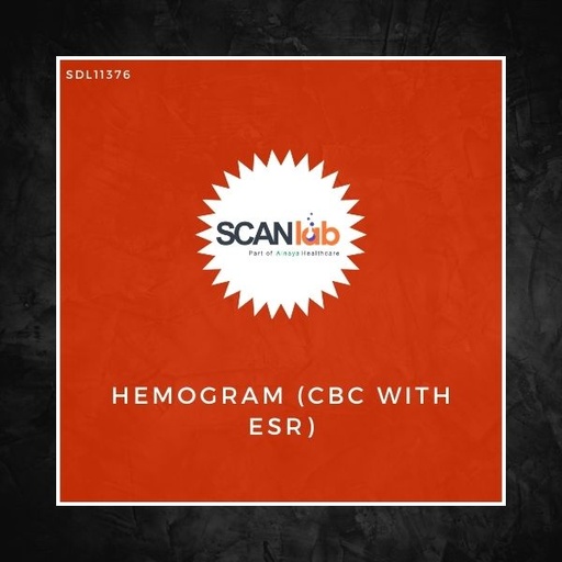 [SDL11376] HEMOGRAM (CBC WITH ESR) (SDL11376)