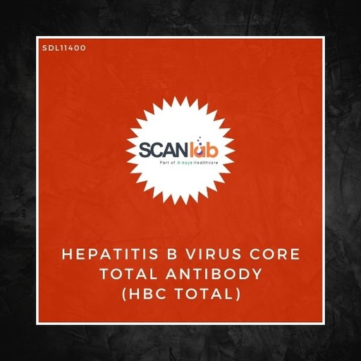 [SDL11400] HEPATITIS B VIRUS CORE TOTAL ANTIBODY (HBC TOTAL) (SDL11400)