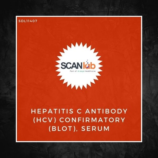 [SDL11407] HEPATITIS C ANTIBODY (HCV) CONFIRMATORY (BLOT), SERUM (SDL11407)