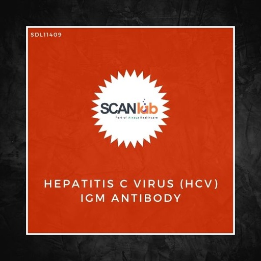 [SDL11409] HEPATITIS C VIRUS (HCV) IGM ANTIBODY (SDL11409)