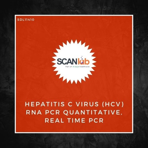 [SDL11410] HEPATITIS C VIRUS (HCV) RNA PCR QUANTITATIVE, REAL TIME PCR (SDL11410)