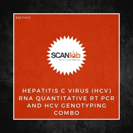 [SDL11412] HEPATITIS C VIRUS (HCV) RNA QUANTITATIVE RT PCR AND HCV GENOTYPING COMBO (SDL11412)