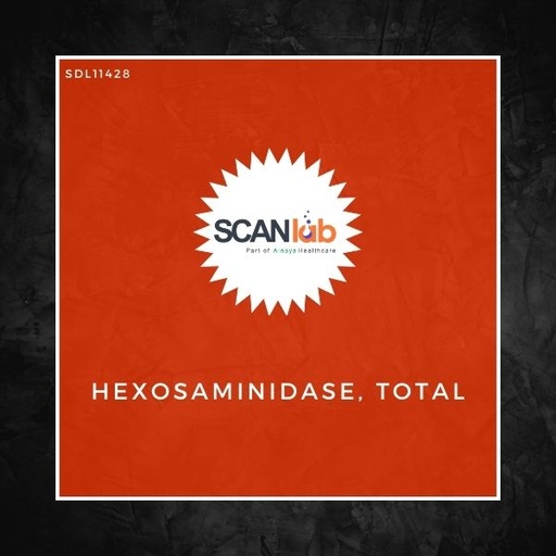 [SDL11428] HEXOSAMINIDASE, TOTAL (SDL11428)