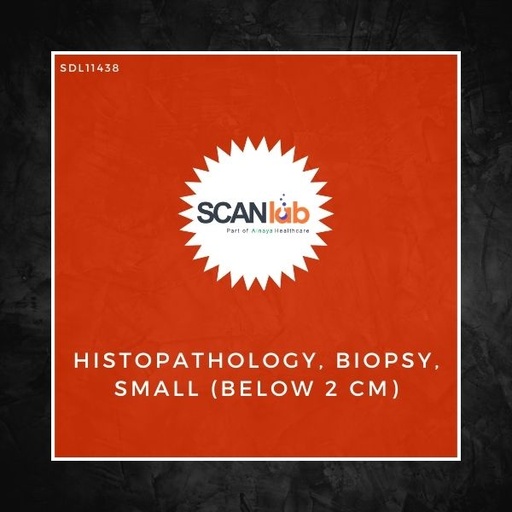 [SDL11438] HISTOPATHOLOGY, BIOPSY, SMALL (BELOW 2 CM) (SDL11438)