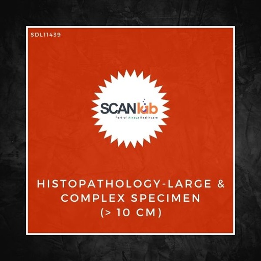 [SDL11439] HISTOPATHOLOGY-LARGE & COMPLEX SPECIMEN (> 10 CM) (SDL11439)