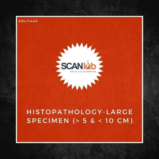 [SDL11440] HISTOPATHOLOGY-LARGE SPECIMEN (> 5 & < 10 CM) (SDL11440)