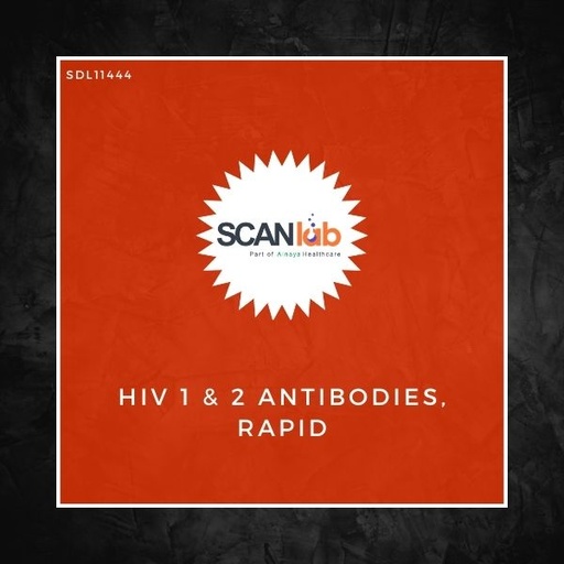 [SDL11444] HIV 1 & 2 ANTIBODIES, RAPID (SDL11444)