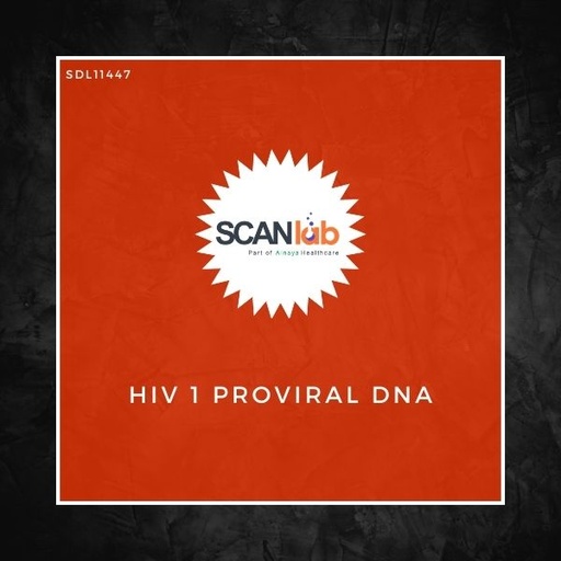 [SDL11447] HIV 1 PROVIRAL DNA (SDL11447)