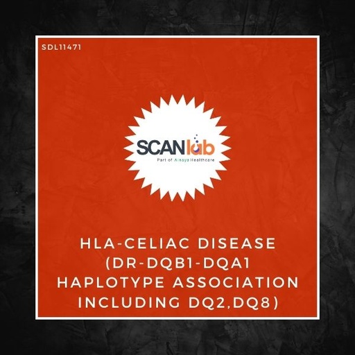 [SDL11471] HLA-CELIAC DISEASE (DR-DQB1- DQA1 HAPLOTYPE ASSOCIATION INCLUDING DQ2,DQ8) (SDL11471)