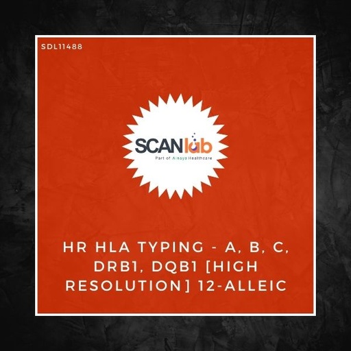 [SDL11488] HR HLA TYPING-A, B, C, DRB1, DQB1 [HIGH RESOLUTION] 12-ALLEIC (SDL11488)