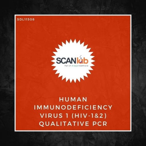 [SDL11508] HUMAN IMMUNODEFICIENCY VIRUS 1 (HIV-1&2) QUALITATIVE PCR (SDL11508)