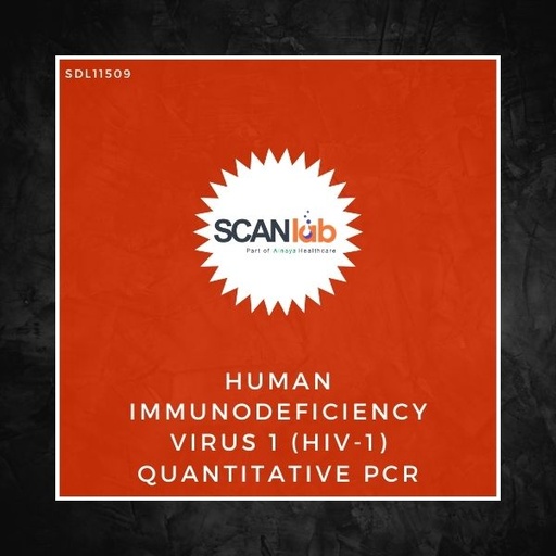[SDL11509] HUMAN IMMUNODEFICIENCY VIRUS 1 (HIV-1) QUANTITATIVE PCR (SDL11509)