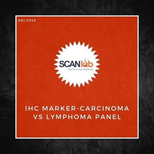 [SDL11543] IHC MARKER-CARCINOMA VS LYMPHOMA PANEL (SDL11543)