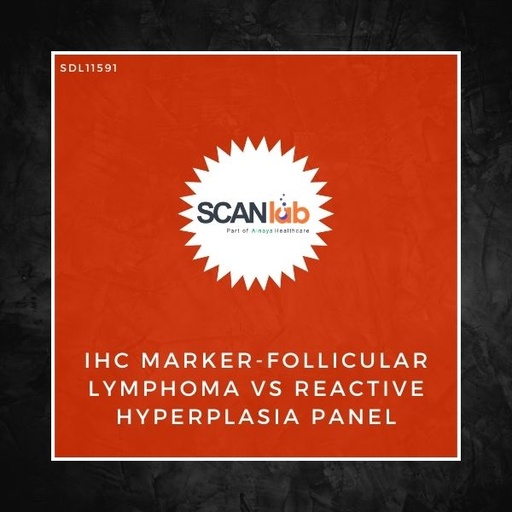 [SDL11591] IHC MARKER-FOLLICULAR LYMPHOMA VS REACTIVE HYPERPLASIA PANEL (SDL11591)
