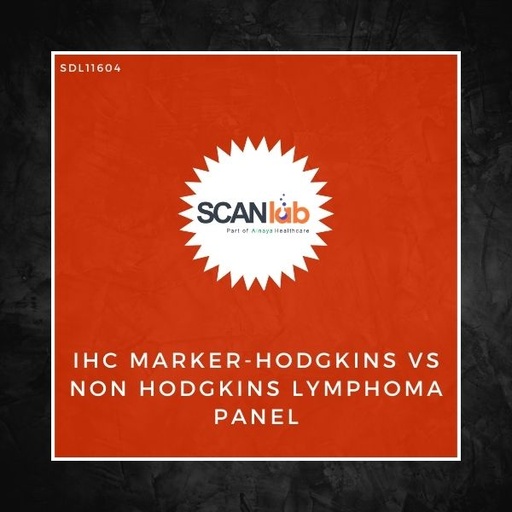 [SDL11604] IHC MARKER-HODGKINS VS NON HODGKINS LYMPHOMA PANEL (SDL11604)