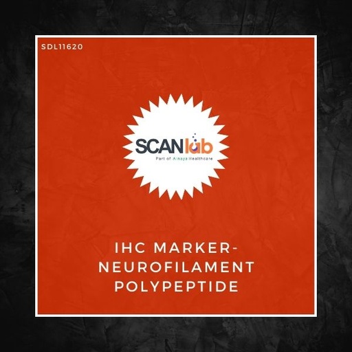 [SDL11620] IHC MARKER-NEUROFILAMENT POLYPEPTIDE (SDL11620)