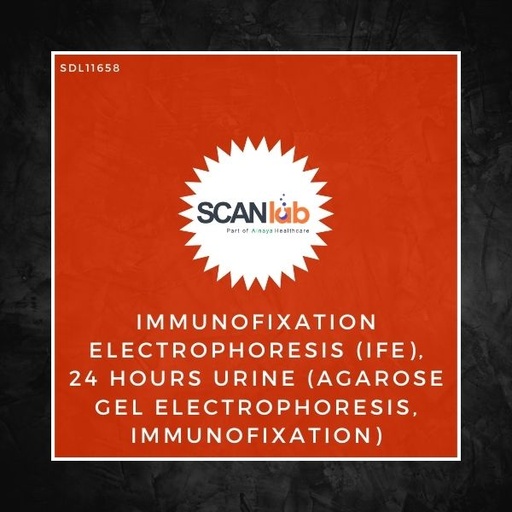 [SDL11658] IMMUNOFIXATION ELECTROPHORESIS (IFE), 24 HOURS URINE (AGAROSE GEL ELECTROPHORESIS, IMMUNOFIXATION) (SDL11658)