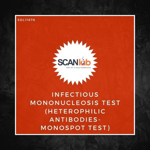 [SDL11676] INFECTIOUS MONONUCLEOSIS TEST (HETEROPHILIC ANTIBODIES-MONOSPOT TEST) (SDL11676)