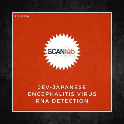 [SDL11730] JEV-JAPANESE ENCEPHALITIS VIRUS RNA DETECTION (SDL11730)