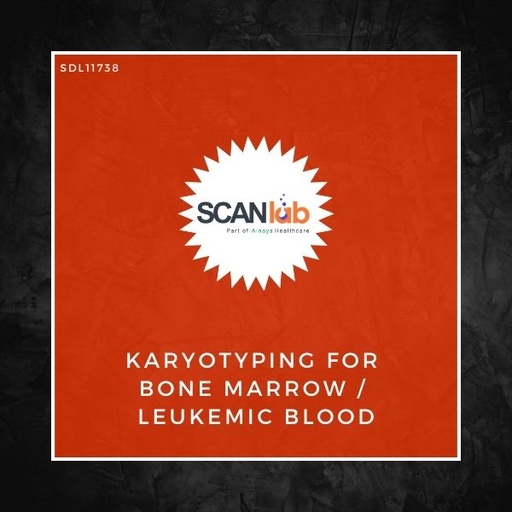 [SDL11738] KARYOTYPING FOR BONE MARROW/LEUKEMIC BLOOD (SDL11738)