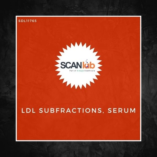 [SDL11765] LDL SUBFRACTIONS, SERUM (SDL11765)