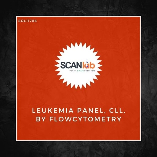[SDL11786] LEUKEMIA PANEL, CLL, BY FLOWCYTOMETRY (SDL11786)