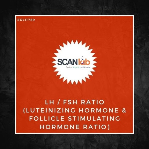 [SDL11789] LH/FSH RATIO (LUTEINIZING HORMONE & FOLLICLE STIMULATING HORMONE RATIO) (SDL11789)