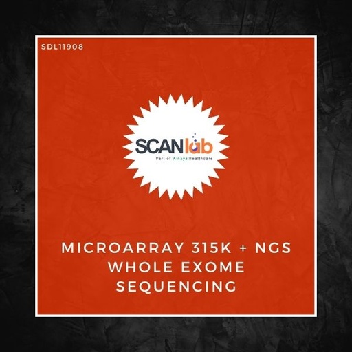 [SDL11908] MICROARRAY 315K+NGS WHOLE EXOME SEQUENCING (SDL11908)