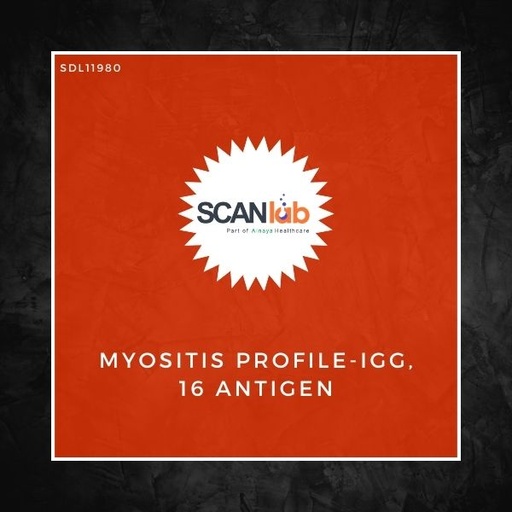 [SDL11980] MYOSITIS PROFILE-IGG, 16 ANTIGEN (SDL11980)